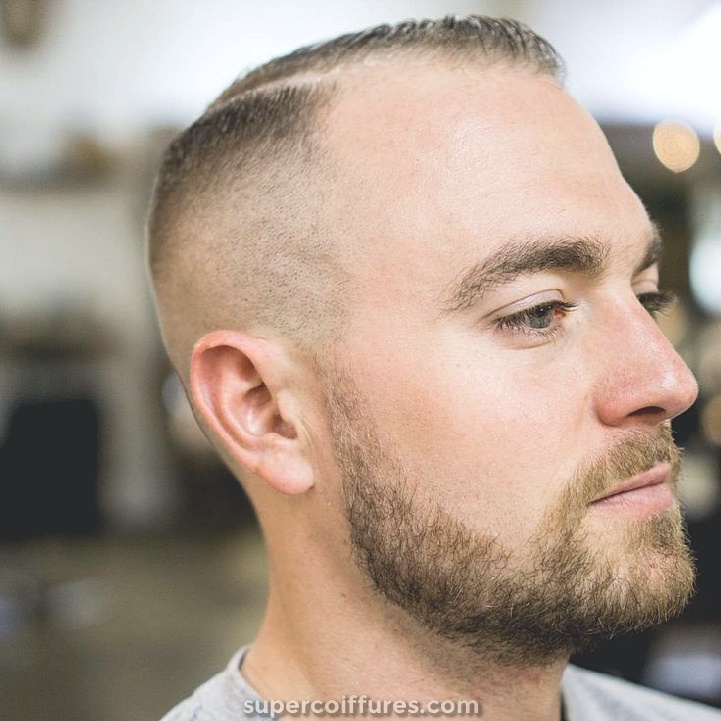 15 coiffures merveilleuses pour les hommes chauve